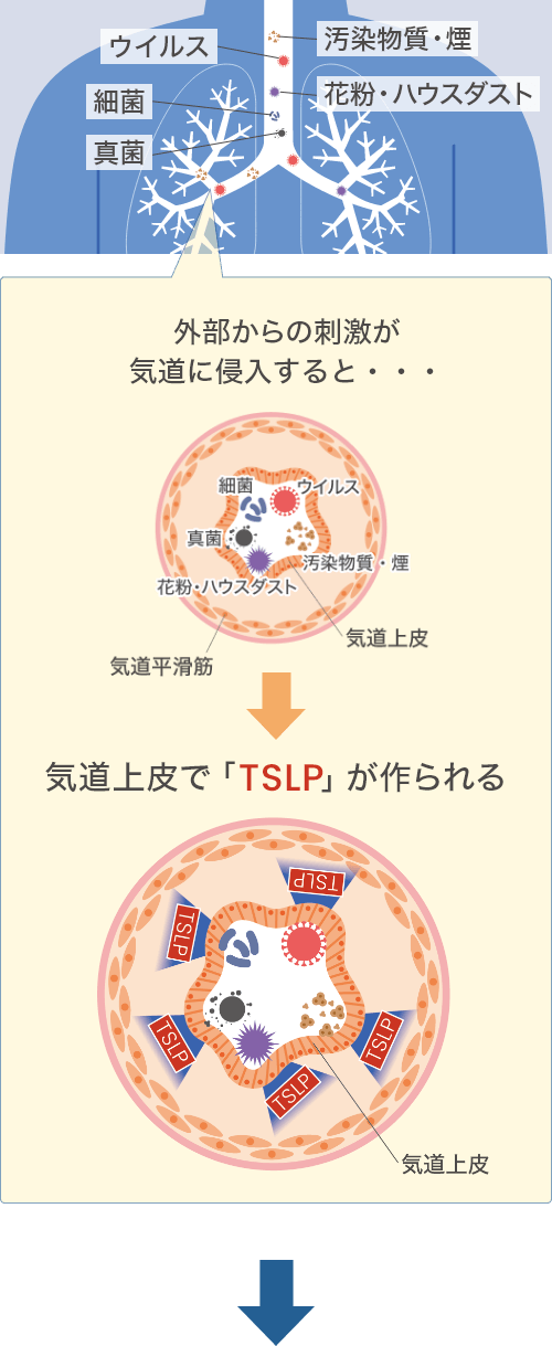 TSLPが作られる時の気道イラスト