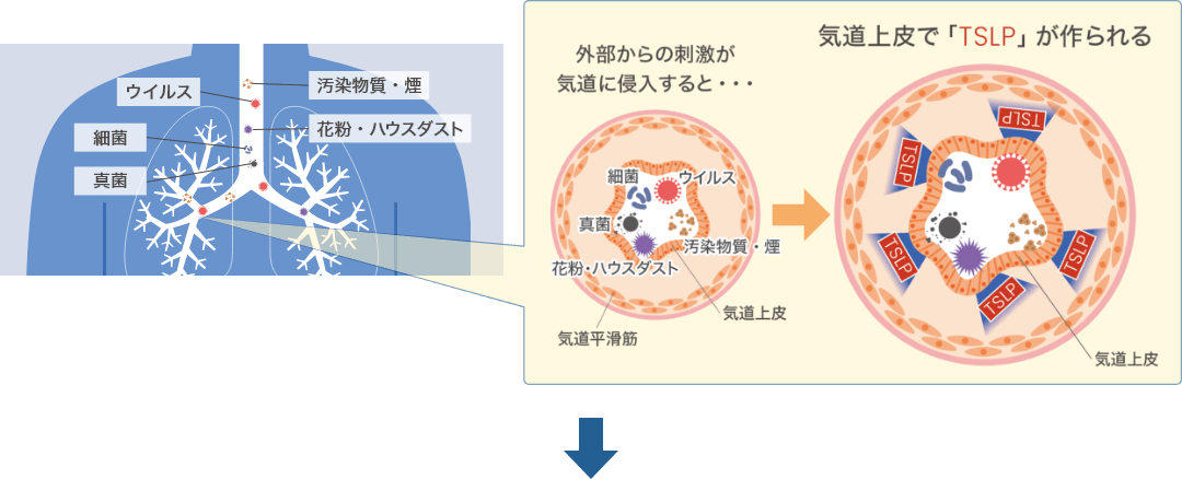 TSLPが作られる時の気道イラスト